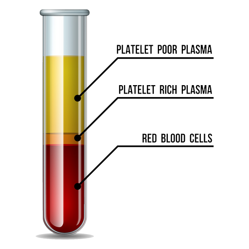 Diagram of blood vial separated into plasma and red blood cells
