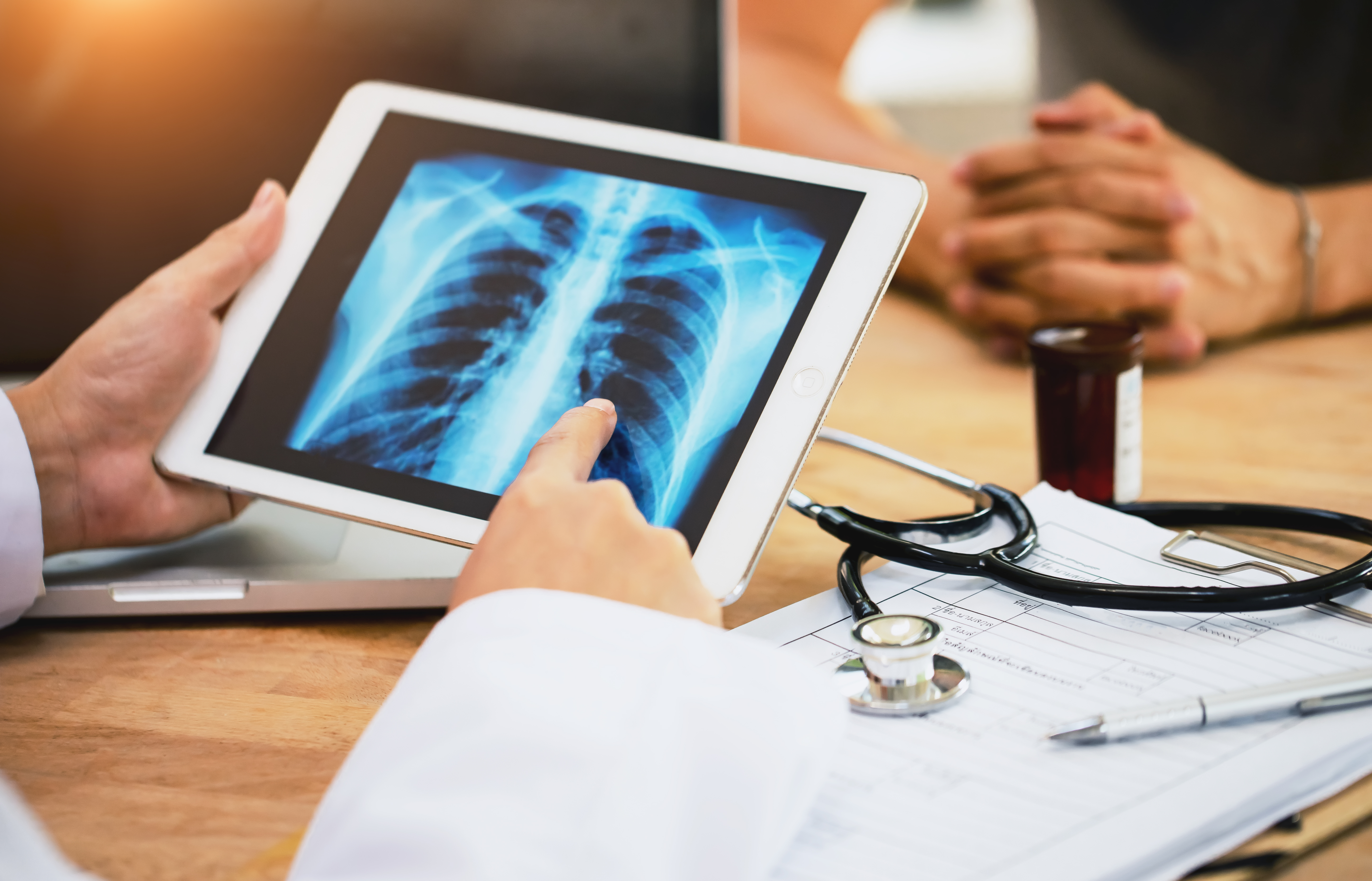 Low-dose CT screenings offer early lung cancer detection